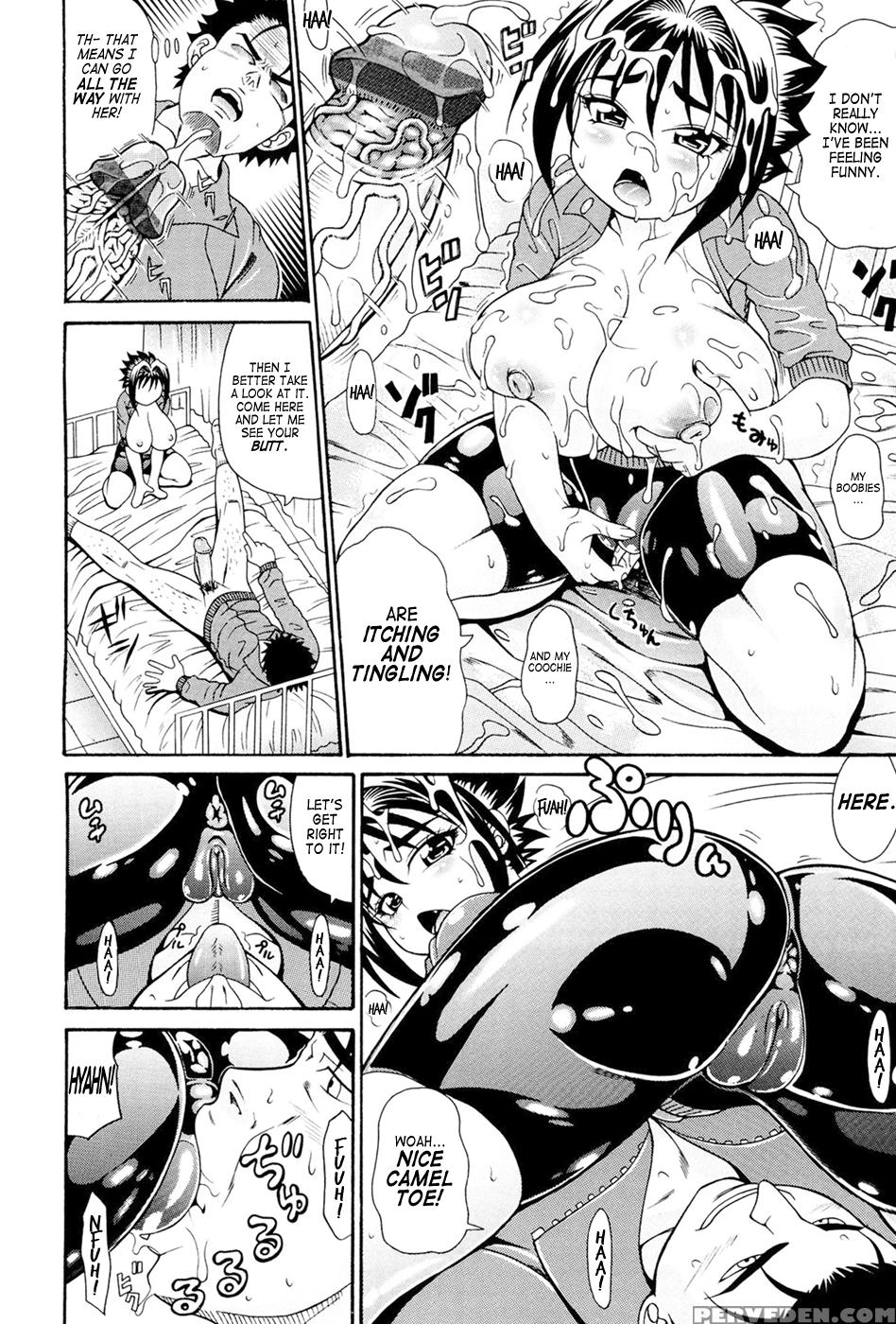 Koisuru Purinpai Ch.5 (the Energetic Girl And Her First Medic(k)al Treatment) - Original Work 1