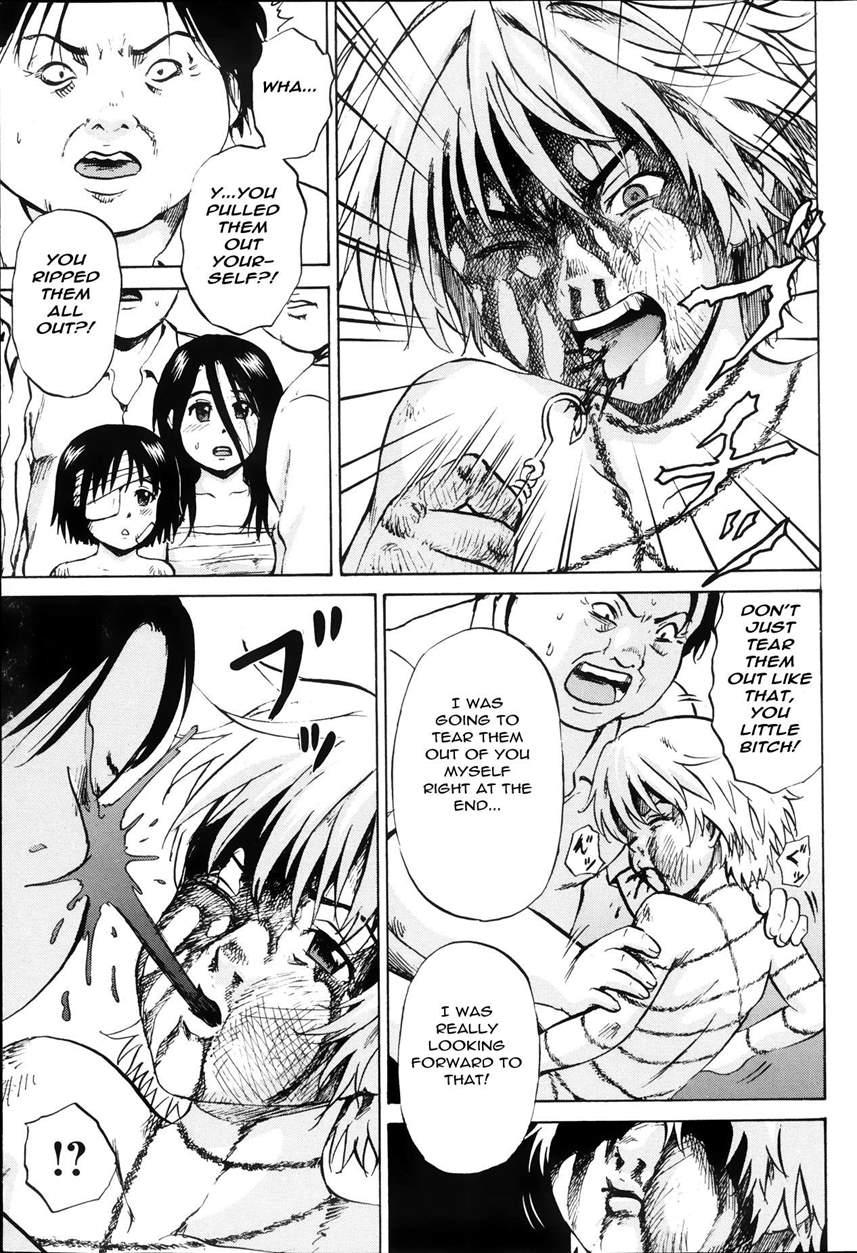 Grievously Wounded Girls 16